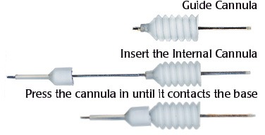 腦部給藥導管(Cannulas)